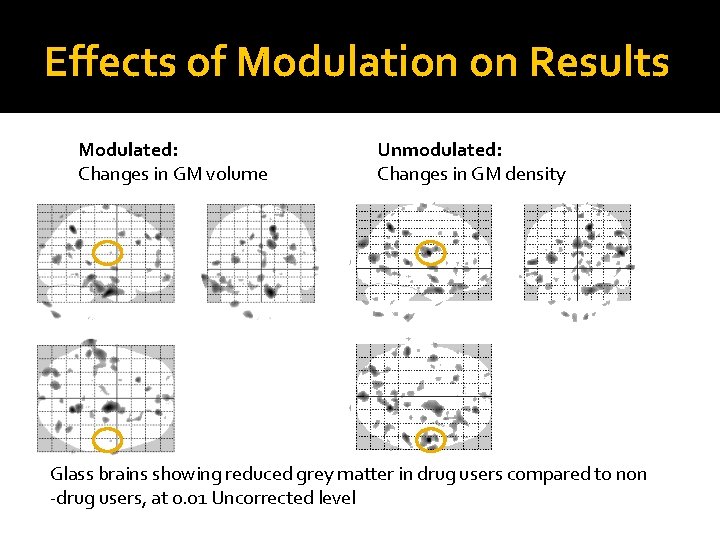 Effects of Modulation on Results Modulated: Changes in GM volume Unmodulated: Changes in GM