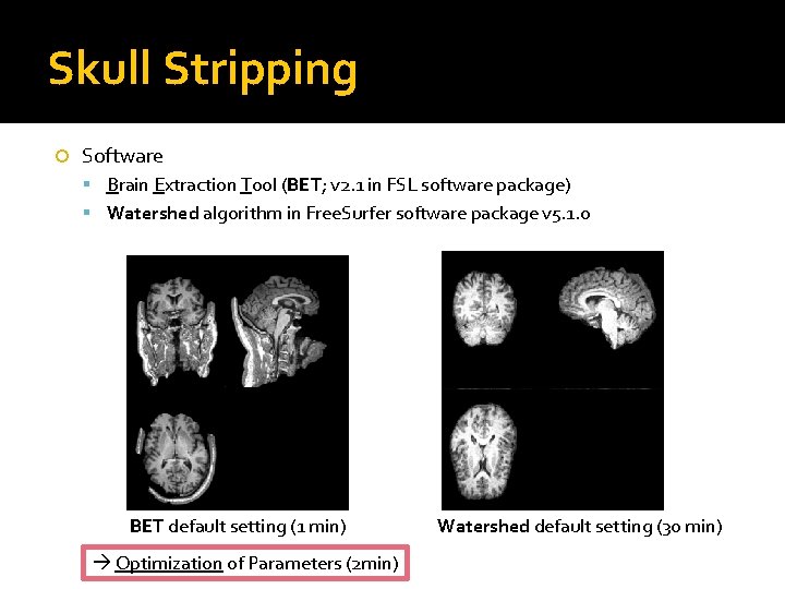 Skull Stripping Software Brain Extraction Tool (BET; v 2. 1 in FSL software package)