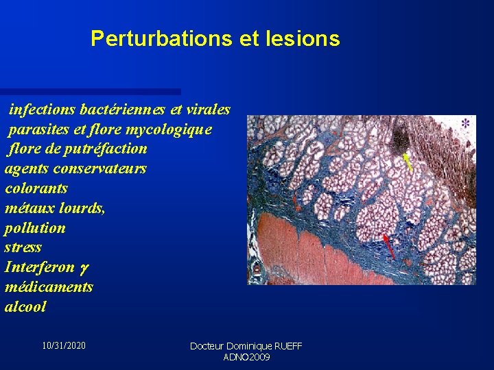Perturbations et lesions infections bactériennes et virales parasites et flore mycologique flore de putréfaction