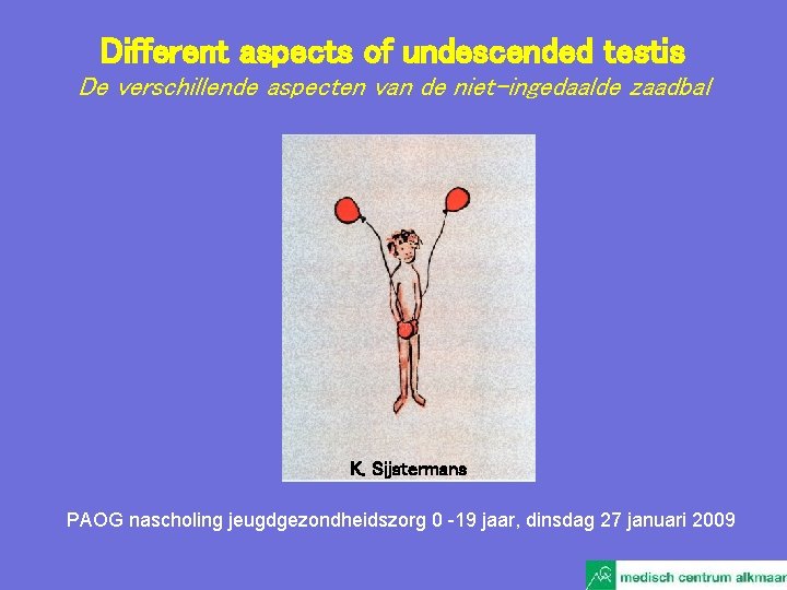 Different aspects of undescended testis De verschillende aspecten van de niet-ingedaalde zaadbal K. Sijstermans