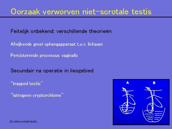 Oorzaak verworven niet-scrotale testis Feitelijk onbekend: verschillende theorieën Afwijkende groei ophangapparaat t. o. v. Oorzaak verworven niet-scrotale testis Feitelijk onbekend: verschillende theorieën Afwijkende groei ophangapparaat t. o. v.