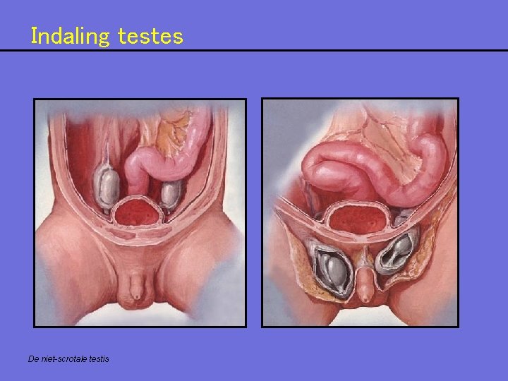 Indaling testes De niet-scrotale testis Indaling testes De niet-scrotale testis
