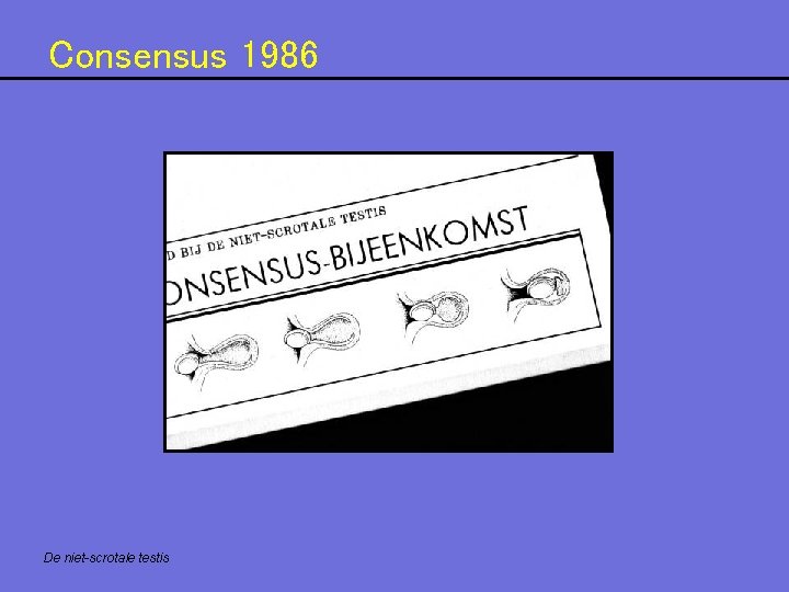 Consensus 1986 De niet-scrotale testis 