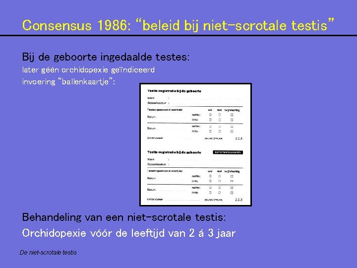 Consensus 1986: “beleid bij niet-scrotale testis” Bij de geboorte ingedaalde testes: later géén orchidopexie