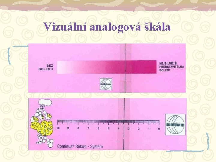 Vizuální analogová škála 