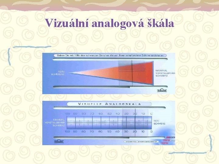 Vizuální analogová škála 
