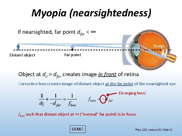 Myopia (nearsightedness) If nearsighted, far point dfar < ∞ Image Distant object Far point