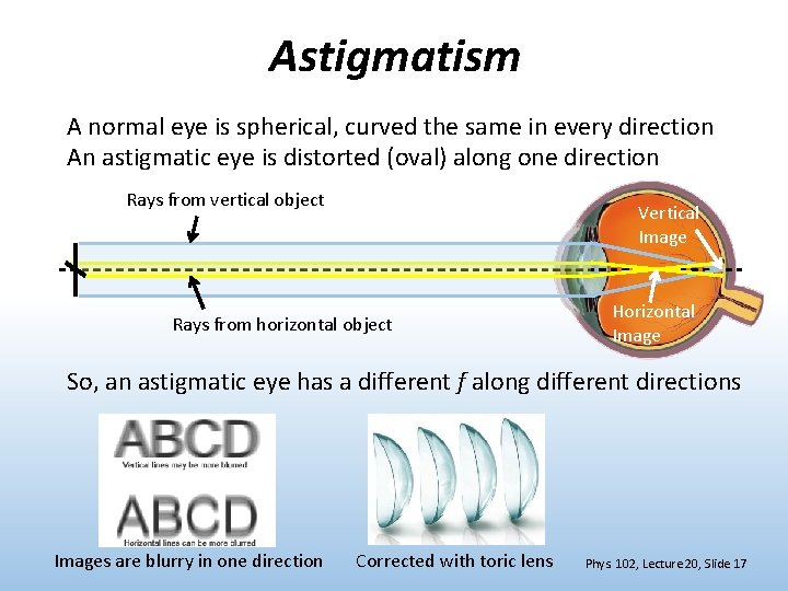 Astigmatism A normal eye is spherical, curved the same in every direction An astigmatic