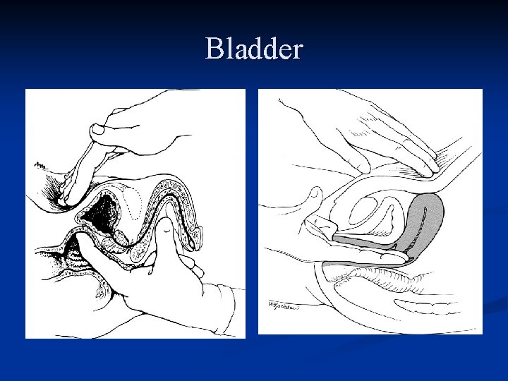 Bladder 