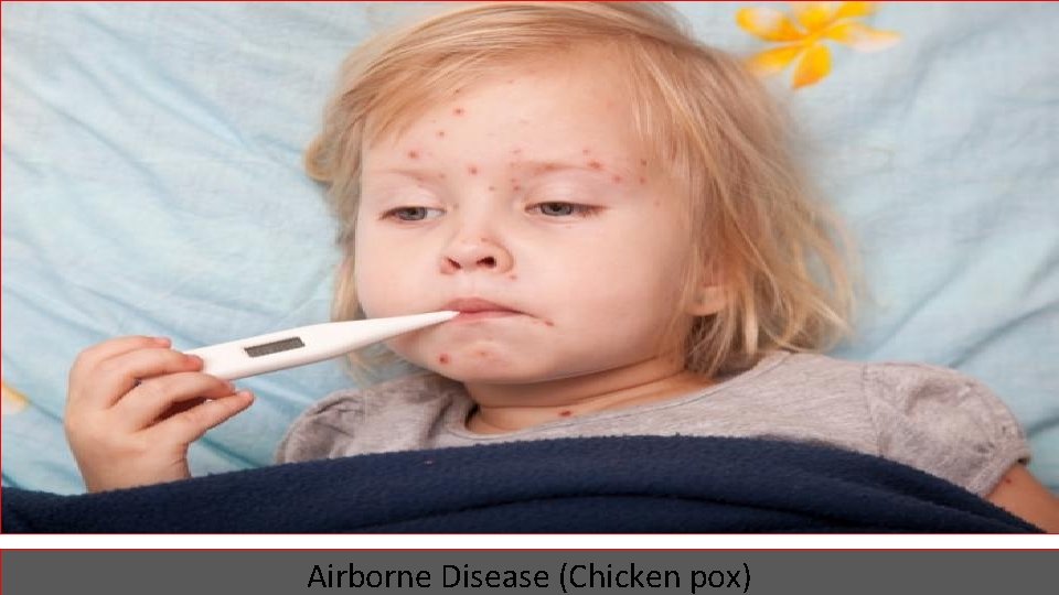 Airborne Disease (Chicken pox) 