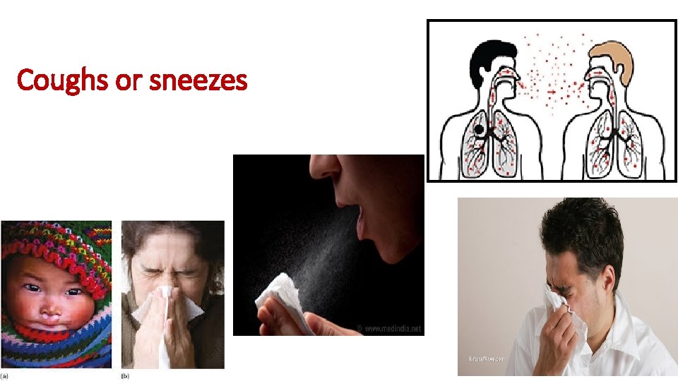 Coughs or sneezes 