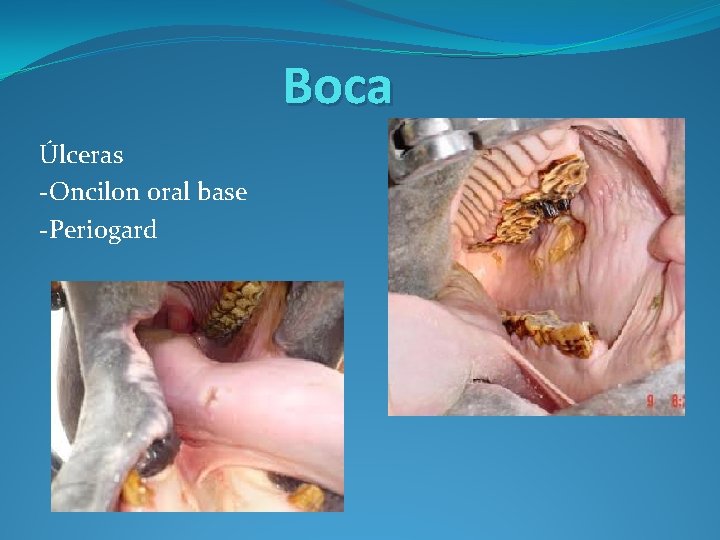 Boca Úlceras -Oncilon oral base -Periogard 