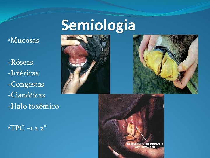 Semiologia • Mucosas -Róseas -Ictéricas -Congestas -Cianóticas -Halo toxêmico • TPC – 1 a