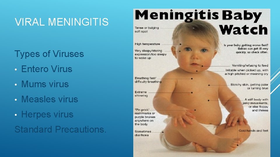 VIRAL MENINGITIS Types of Viruses • Entero Virus • Mums virus • Measles virus