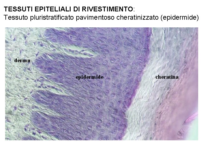 TESSUTI EPITELIALI DI RIVESTIMENTO: Tessuto pluristratificato pavimentoso cheratinizzato (epidermide) derma epidermide cheratina 