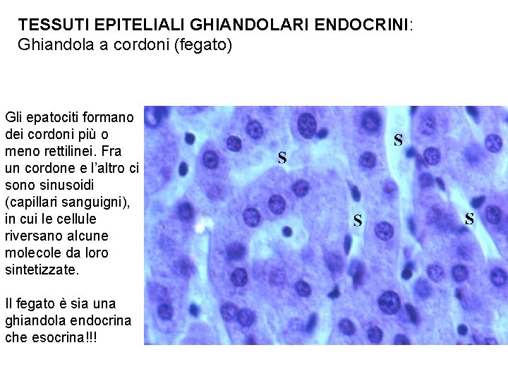 TESSUTI EPITELIALI GHIANDOLARI ENDOCRINI: Ghiandola a cordoni (fegato) Gli epatociti formano dei cordoni più