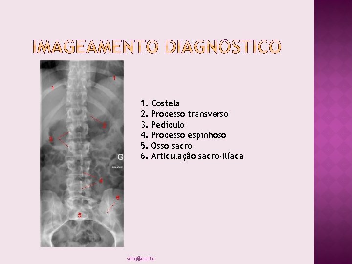 1. 2. 3. 4. 5. 6. Costela Processo transverso Pedículo Processo espinhoso Osso sacro