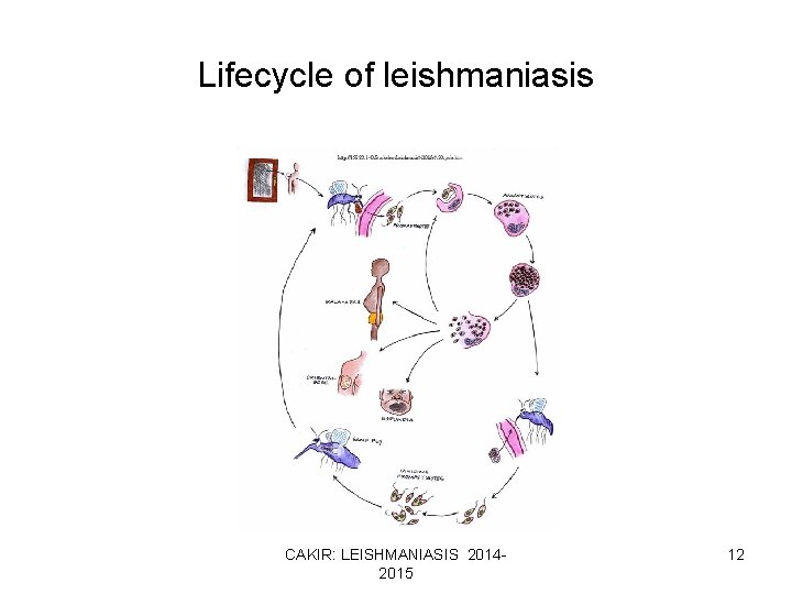 Lifecycle of leishmaniasis CAKIR: LEISHMANIASIS 20142015 12 