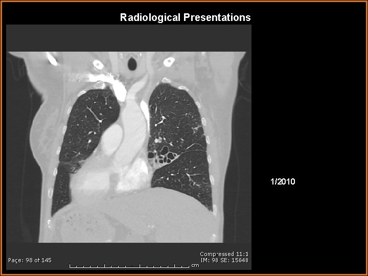 Radiological Presentations 1/2010 