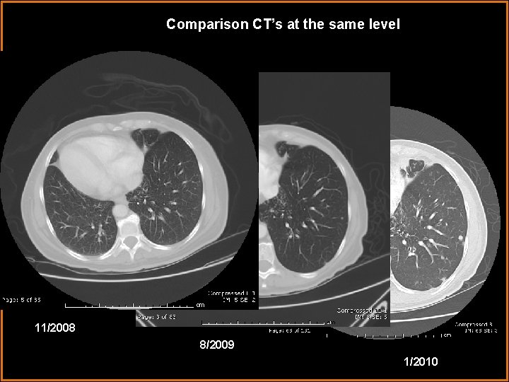 Comparison CT’s at the same level 11/2008 8/2009 1/2010 