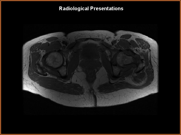 Radiological Presentations 