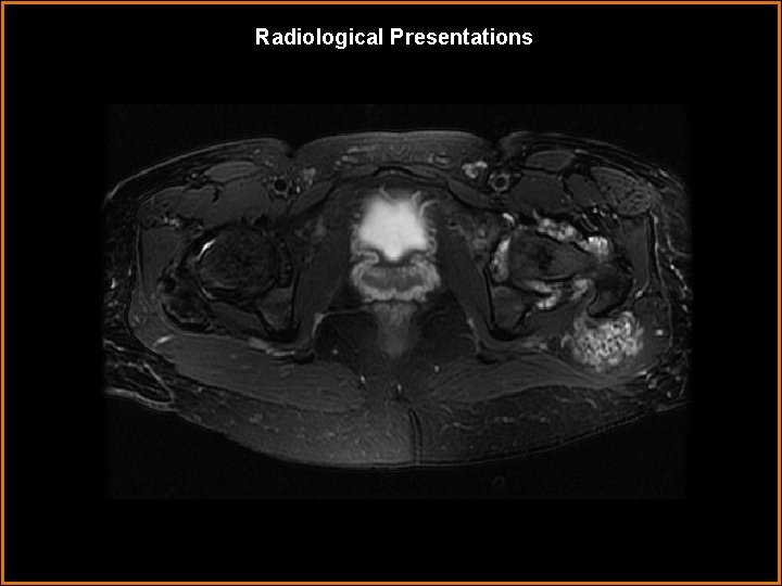 Radiological Presentations 