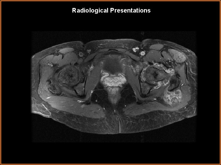Radiological Presentations 