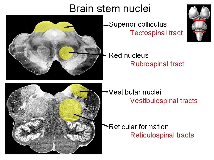 Brain stem nuclei Superior colliculus Tectospinal tract Red nucleus Rubrospinal tract Vestibular nuclei Vestibulospinal