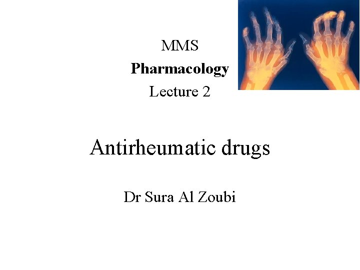 MMS Pharmacology Lecture 2 Antirheumatic drugs Dr Sura Al Zoubi 