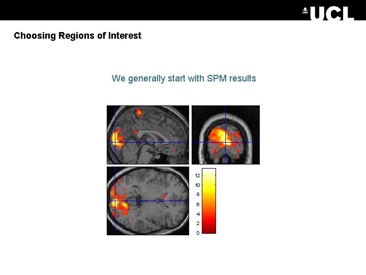 Choosing Regions of Interest We generally start with SPM results 12 10 8 6
