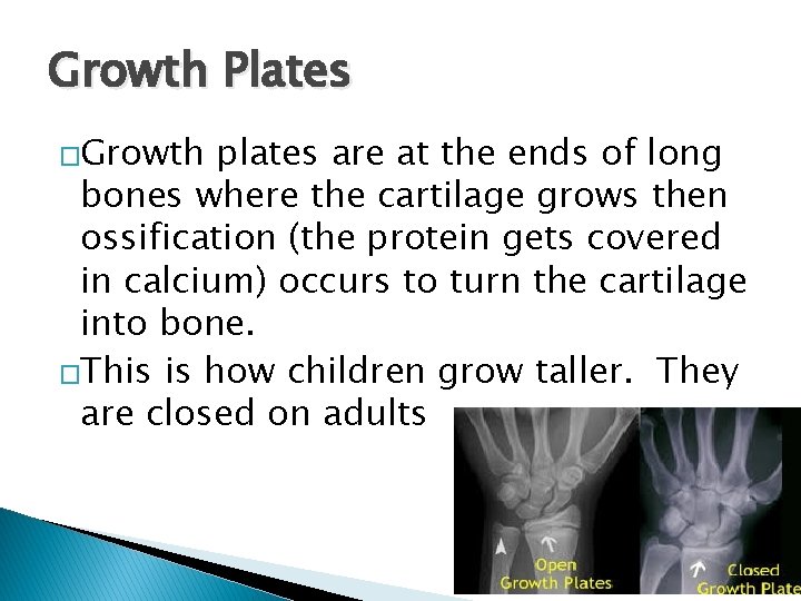 Growth Plates �Growth plates are at the ends of long bones where the cartilage