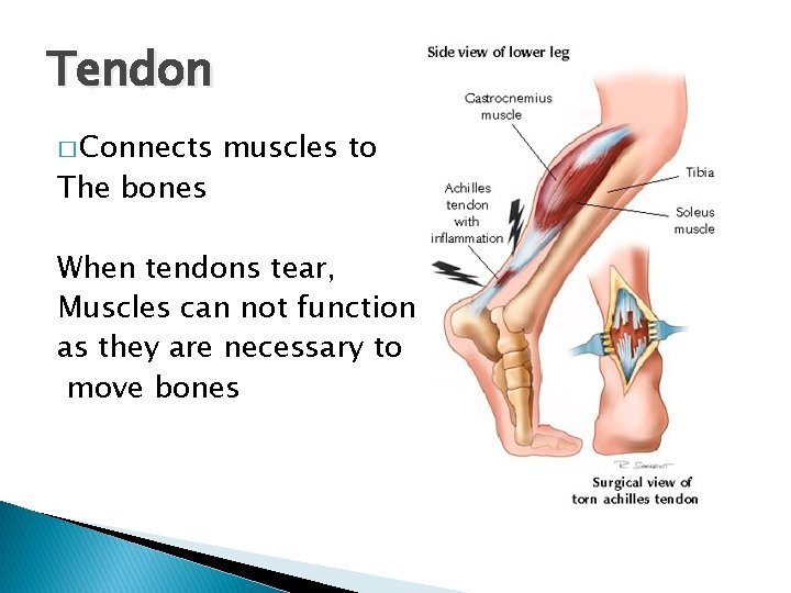 Tendon � Connects The bones muscles to When tendons tear, Muscles can not function