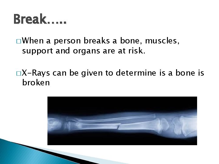 Break…. . � When a person breaks a bone, muscles, support and organs are