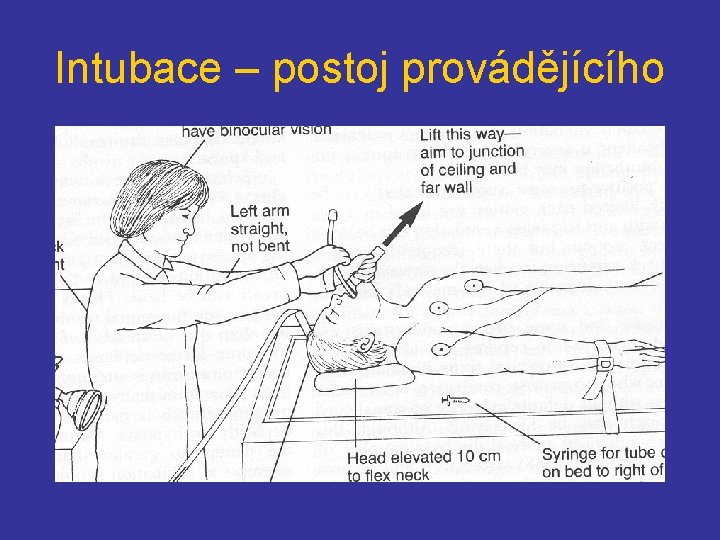 Intubace – postoj provádějícího 