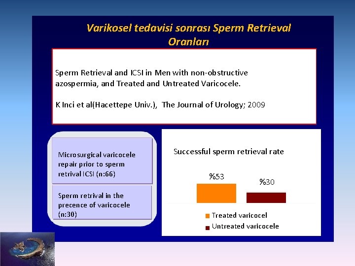 Varikosel tedavisi sonrası Sperm Retrieval Oranları Sperm Retrieval and ICSI in Men with non-obstructive