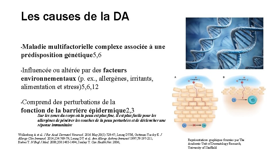 Les causes de la DA Maladie multifactorielle complexe associée à une prédisposition génétique 5,