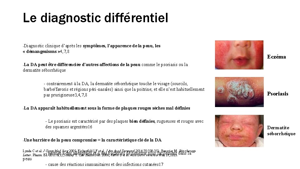 Le diagnostic différentiel Diagnostic clinique d’après les symptômes, l’apparence de la peau, les «