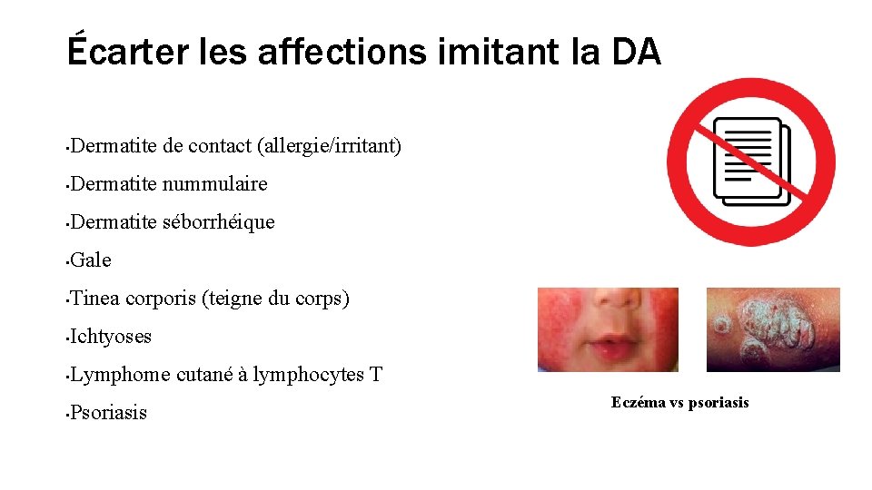 Écarter les affections imitant la DA • Dermatite de contact (allergie/irritant) • Dermatite nummulaire