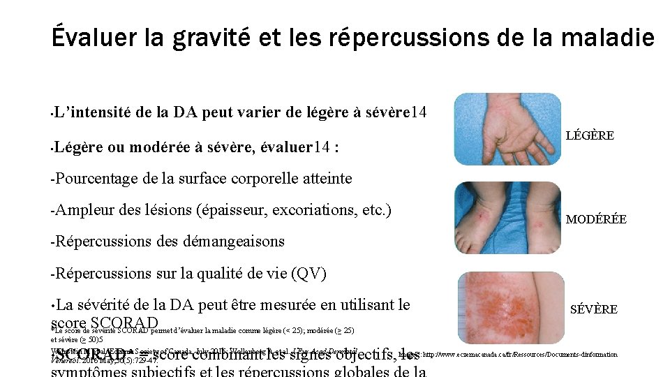 Évaluer la gravité et les répercussions de la maladie • • L’intensité de la