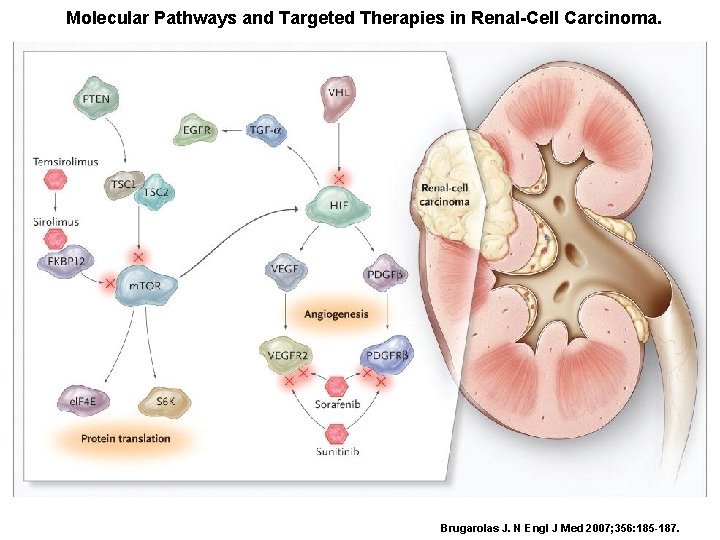 Molecular Pathways and Targeted Therapies in Renal-Cell Carcinoma. Brugarolas J. N Engl J Med