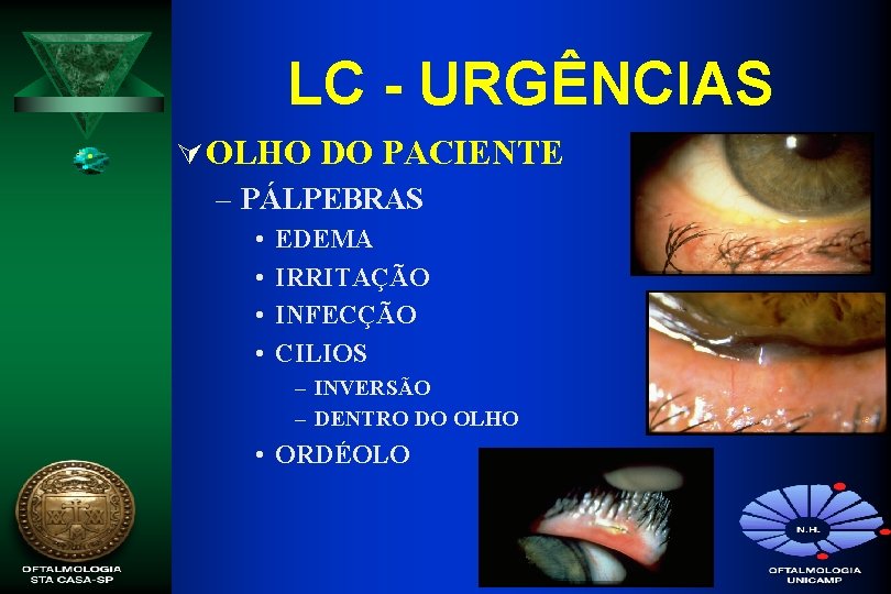 LC - URGÊNCIAS Ú OLHO DO PACIENTE – PÁLPEBRAS • • EDEMA IRRITAÇÃO INFECÇÃO