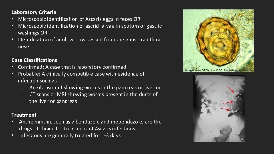 Laboratory Criteria • Microscopic identification of Ascaris eggs in feces OR • Microscopic identification
