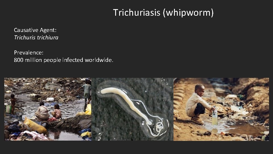 Trichuriasis (whipworm) Causative Agent: Trichuris trichiura Prevalence: 800 million people infected worldwide. 