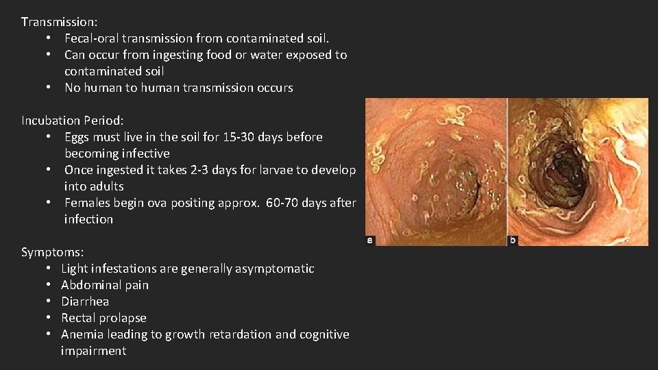 Transmission: • Fecal-oral transmission from contaminated soil. • Can occur from ingesting food or