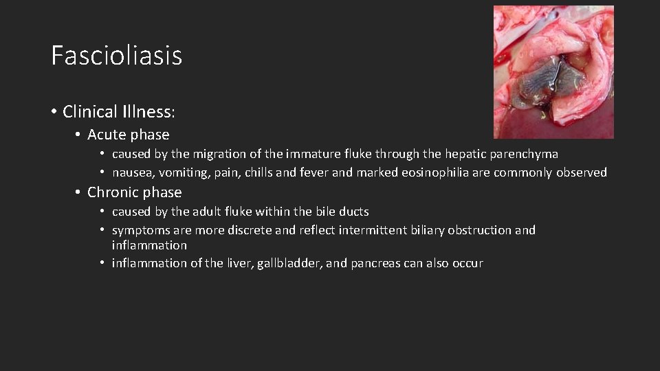 Fascioliasis • Clinical Illness: • Acute phase • caused by the migration of the