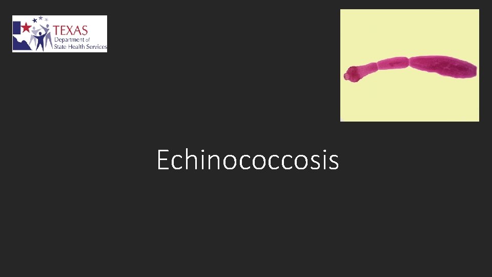 Echinococcosis 