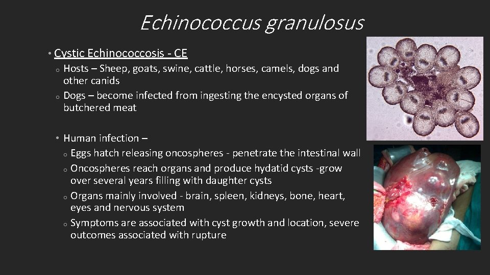 Echinococcus granulosus • Cystic Echinococcosis - CE o Hosts – Sheep, goats, swine, cattle,