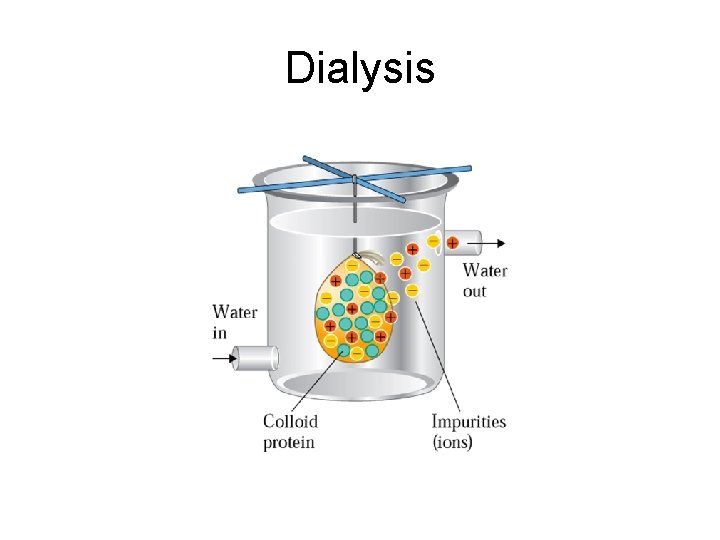 Dialysis 