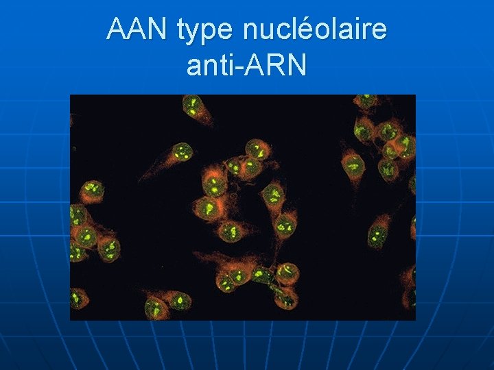 AAN type nucléolaire anti-ARN 