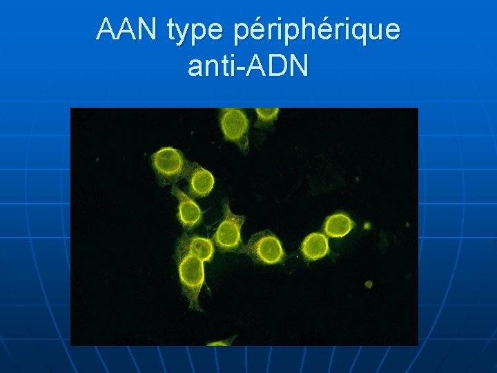 AAN type périphérique anti-ADN 